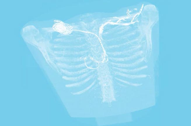 TechSource Systems Pte Ltd